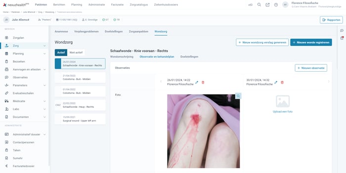 Overzicht-wondverzorging_nexuzhealth-pro-thuisverpleegkundigen