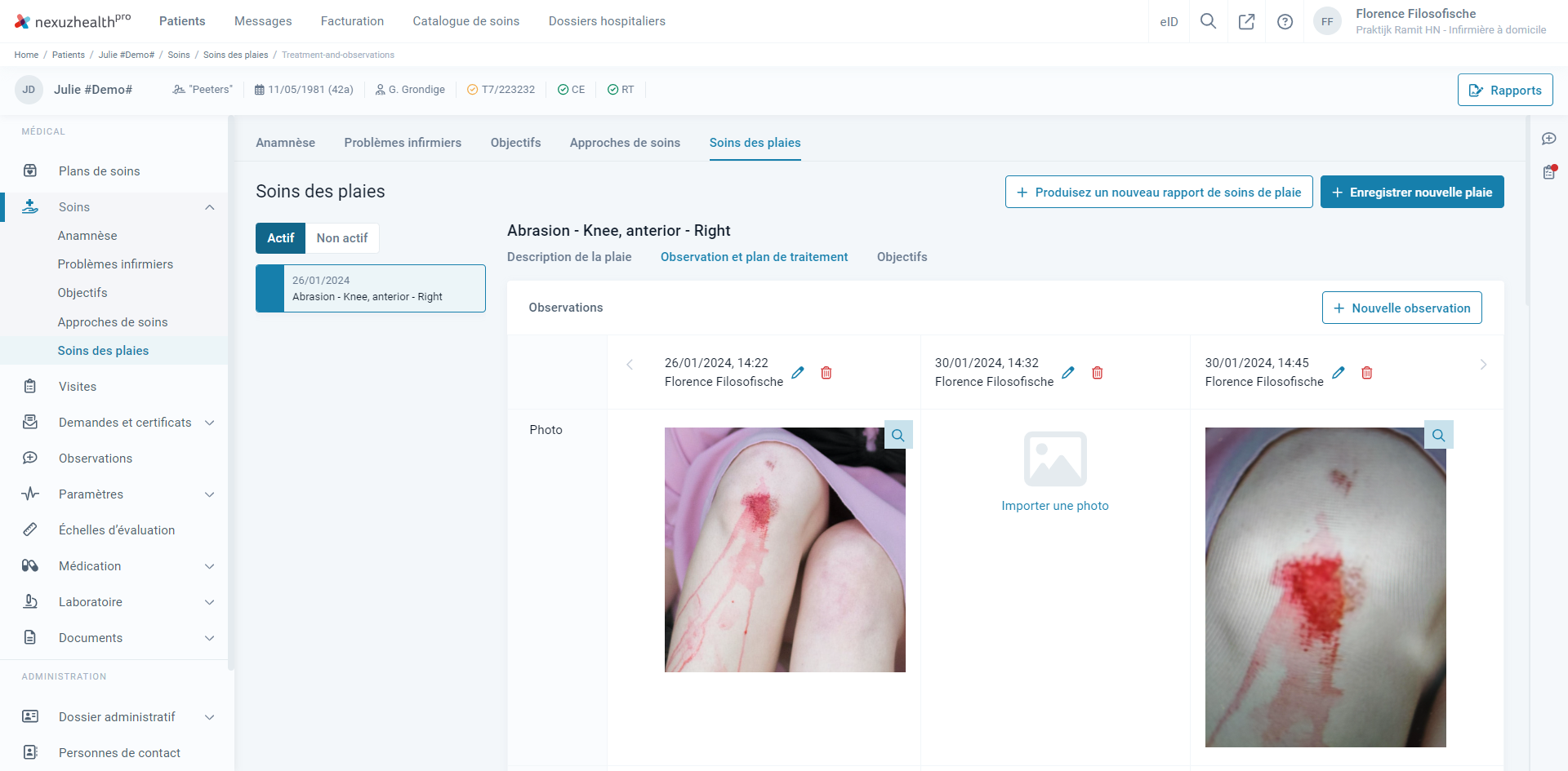 WoundCareFR2